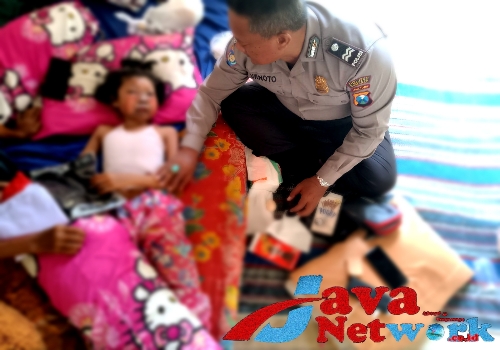 Peserta Pramuka Yang Mengalami Luka Bakar Pada Muka