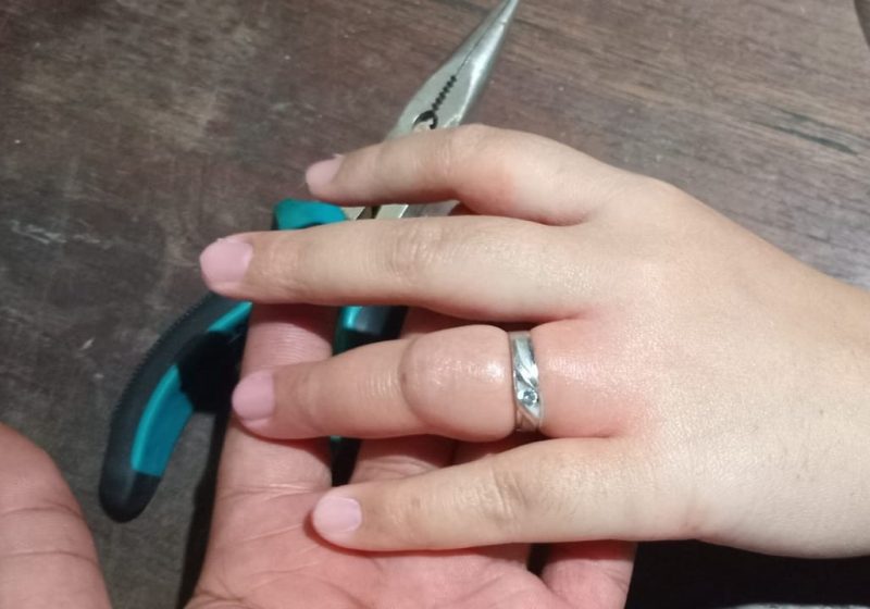 Aksi 10 Menit! Damkar Sumenep Selamatkan Jari Warga Batuan dari Cincin yang Terjebak
